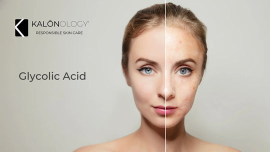 Glycolic Acid, Kalonology Advanced Vitamin C Serum, Skin Care, Vitamin C, Anti Wrinkle, Anti Age