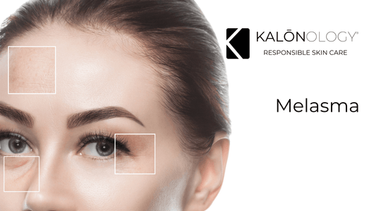 Kalonology Responsible Skin Care Melasma, pigmentation, hyperpigmentation